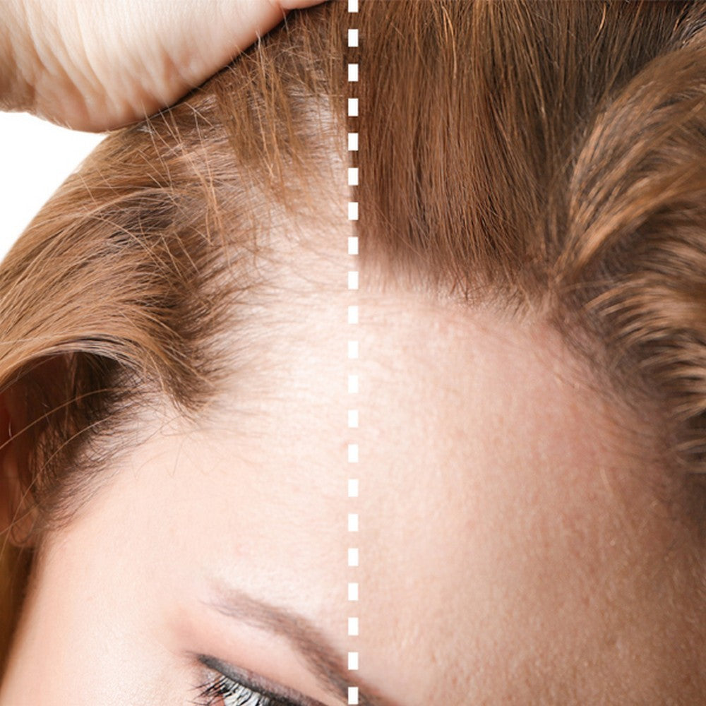 Bifull - Nano Fibras Capilares con Spray de Fijación Fuerte Color Marrón Oscuro 100 ml + 25 g - BFEXT43305